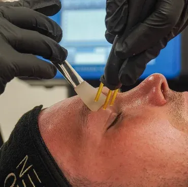 Neogen® Skin Regeneration Treatment